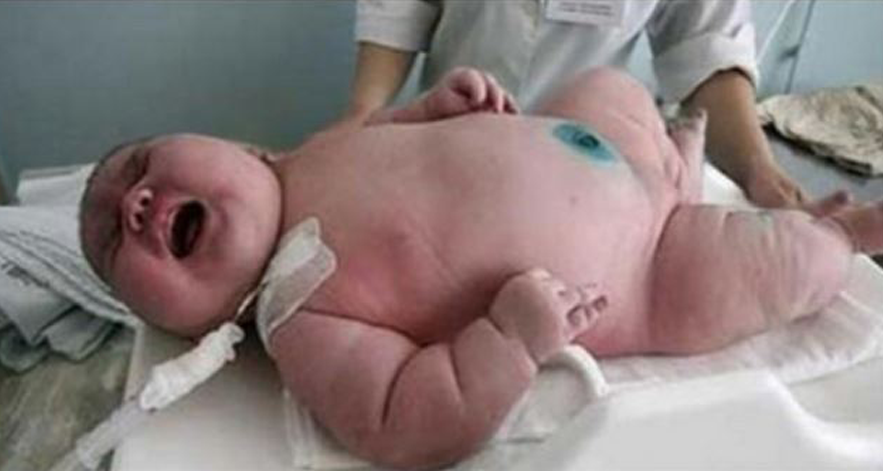Parto record a Perugia, nasce bambino di 40kg
