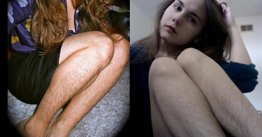 [FOTO] Ragazze con i peli, addio ceretta